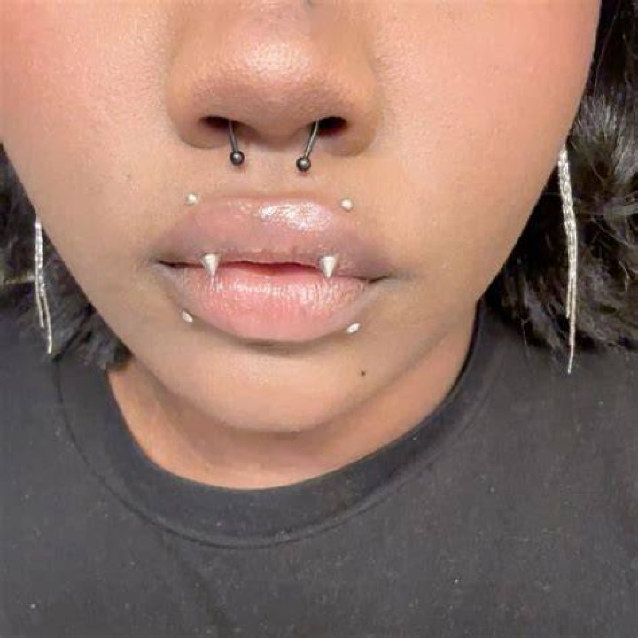 Angel Bites Piercing in 2021 Angel bites, Angel bites piercing, Piercing