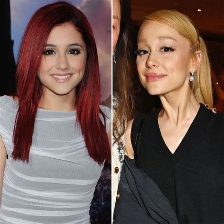 Ariana Grande Before & After The Power of Plastic Surgery! DemotiX