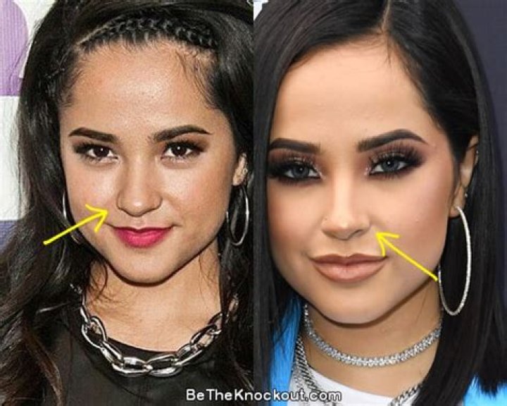 Becky G Plastic Surgery Comparison Photos