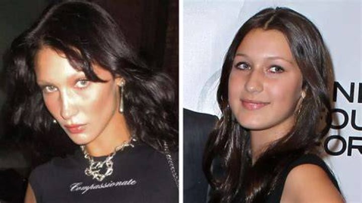 Bella Hadid Regrets Getting a Nose Job at 14