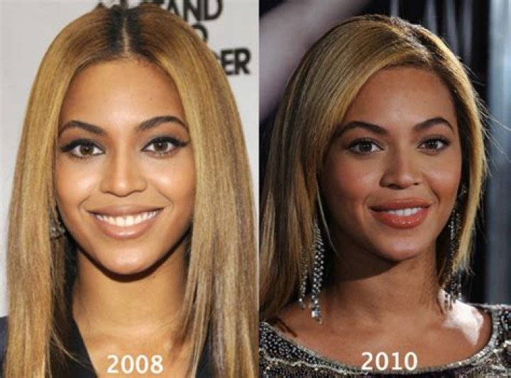 Beyonce Plastic Surgery Comparison Photos