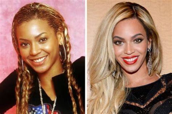 Celebrities Who Bleached Their Skin