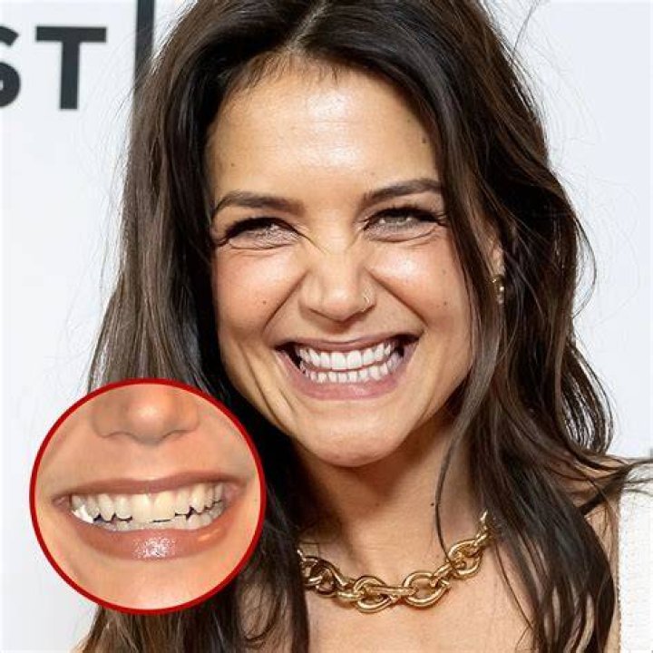 Celebrities With Crooked Teeth Katy Perry, Rachel Weisz, and More