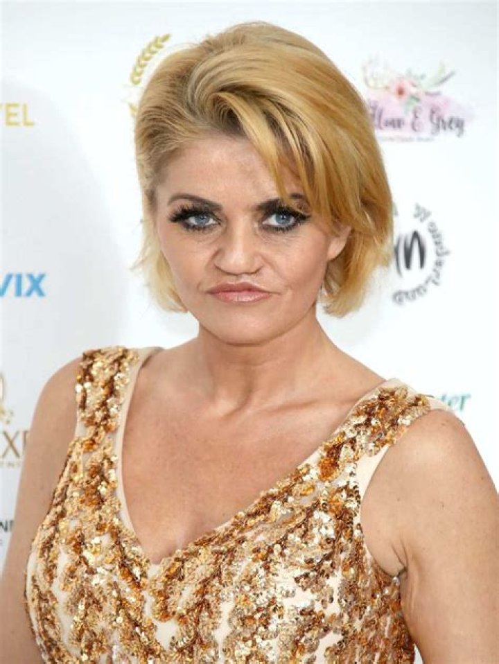 Danniella Westbrook bio Age, kids, net worth, before and after Legit.ng