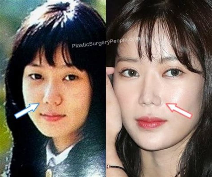 Im Soo Hyang Before And After Plastic Surgery YouTube
