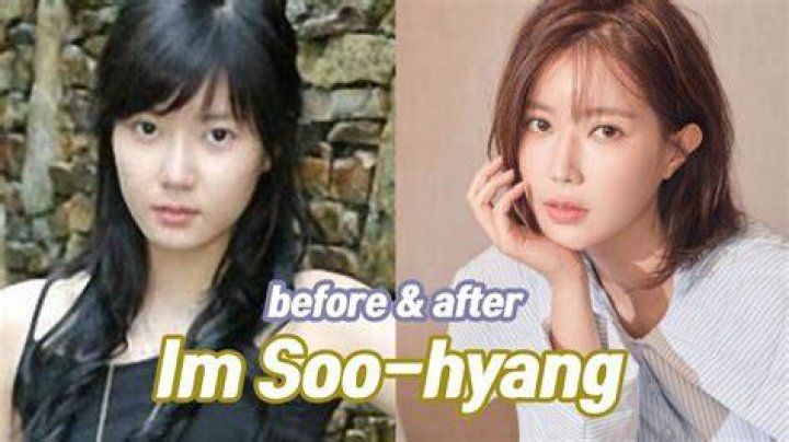 Im Soohyang Before and After 2021