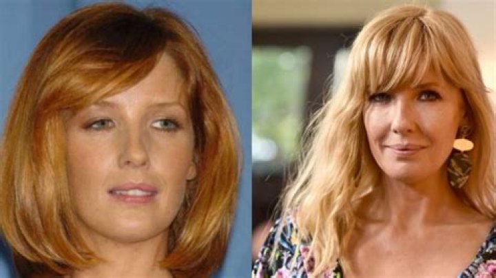 Kelly Reilly Plastic Surgery What Happened to Kelly Reilly Lips?