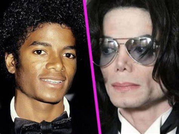 Michael Jackson de la chirurgie esth&eacute;tique tous les deux mois