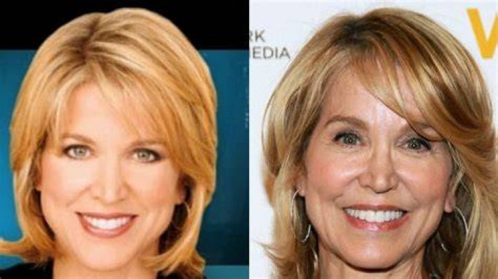 Paula Zahn and her plastic surgery rumors true?
