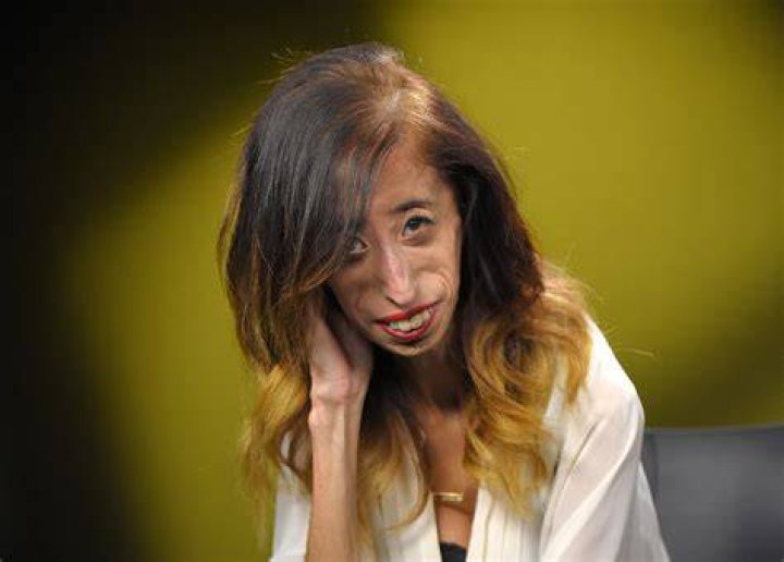 She Was Named World&rsquo;s Ugliest Dog, but &lsquo;She&rsquo;s Just Darling&rsquo; The New