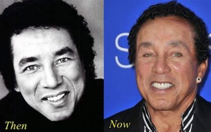 Smokey Robinson Plastic Surgery Before and After Pictures 2024