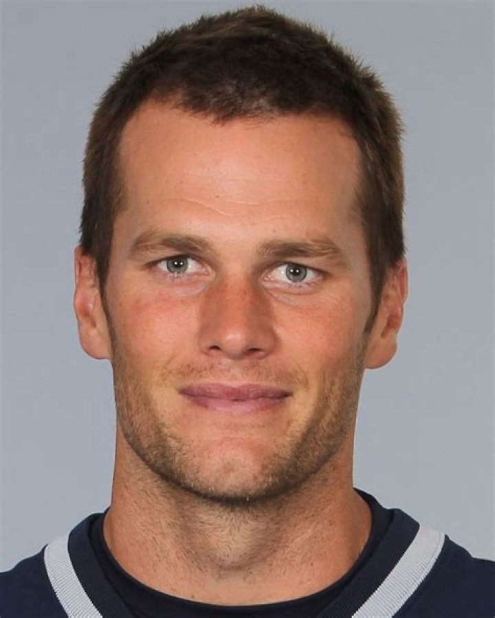 Tom Brady hair and face Open Hair Loss Topics Hair Restoration