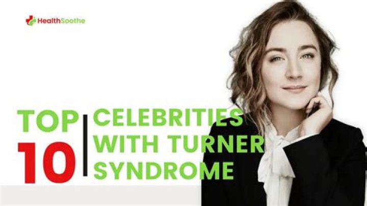 Top 10 Celebrities With Turner Syndrome You Could Never Think Of