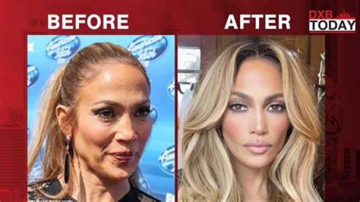 What Plastic Surgery Has Gizelle Bryant Gotten? Body Measurements and